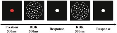 Alterations in white matter integrity and network topological properties are associated with a decrease in global motion perception in older adults